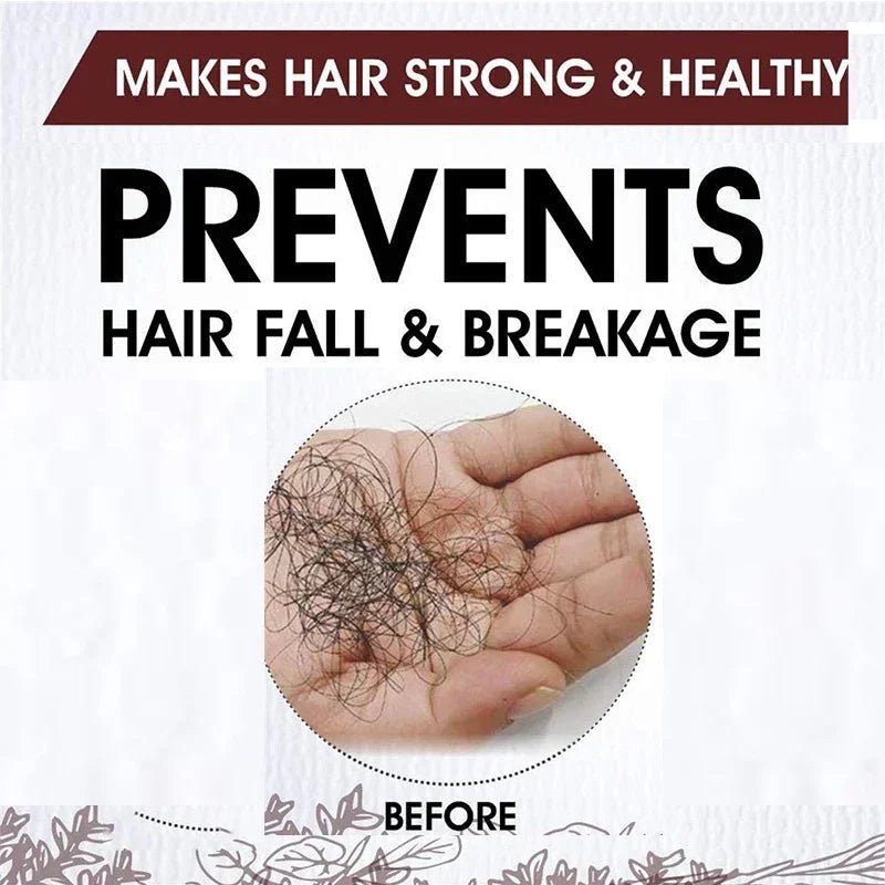 Fast Hair Growth for Men Women Ginger Grow Hair Oil Care Anti Hair Loss Scalp Treatment Serum Products Beauty Health - Image 3