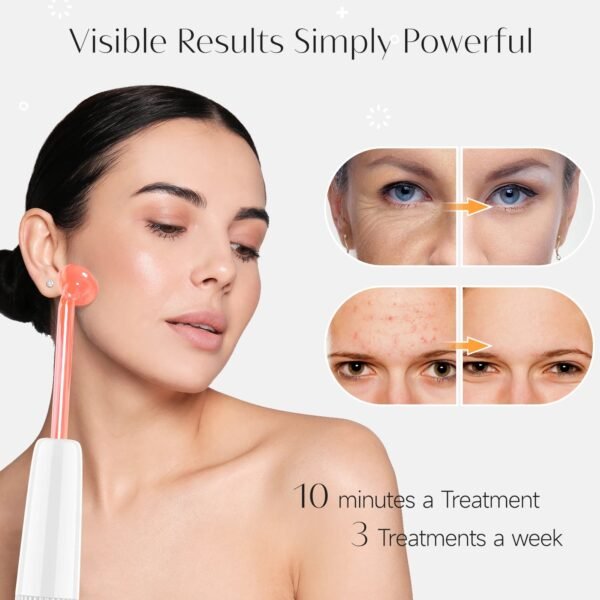 DARSONVAL High Frequency Electrode Wand Machine Neon Electrotherapy Glass Tube Acne Spot Wrinkles Remover Beauty Facial Care - Image 5