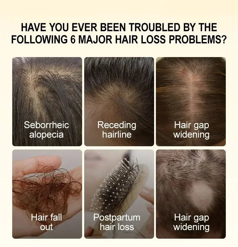 Fast Hair Growth for Men Women Ginger Grow Hair Oil Care Anti Hair Loss Scalp Treatment Serum Products Beauty Health - Image 2